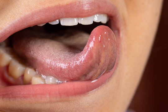 bayu yudhistira recommends asian lesbians sucking tongue pic