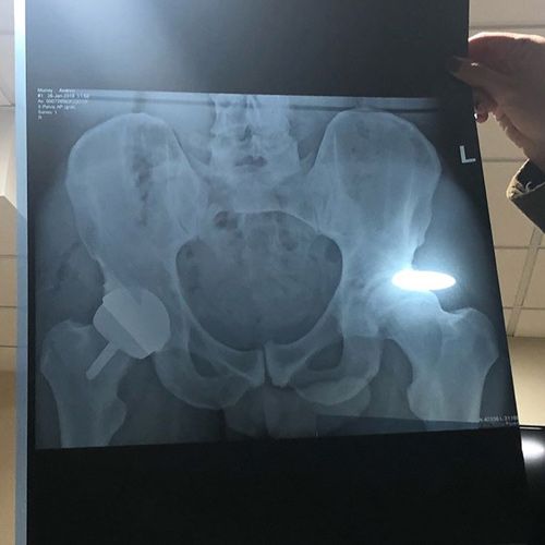 denis mcleod share big dick x ray photos