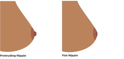 Best of Nipple sinks in when lying down