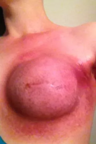 dannyela burgos recommends close up boob pics pic