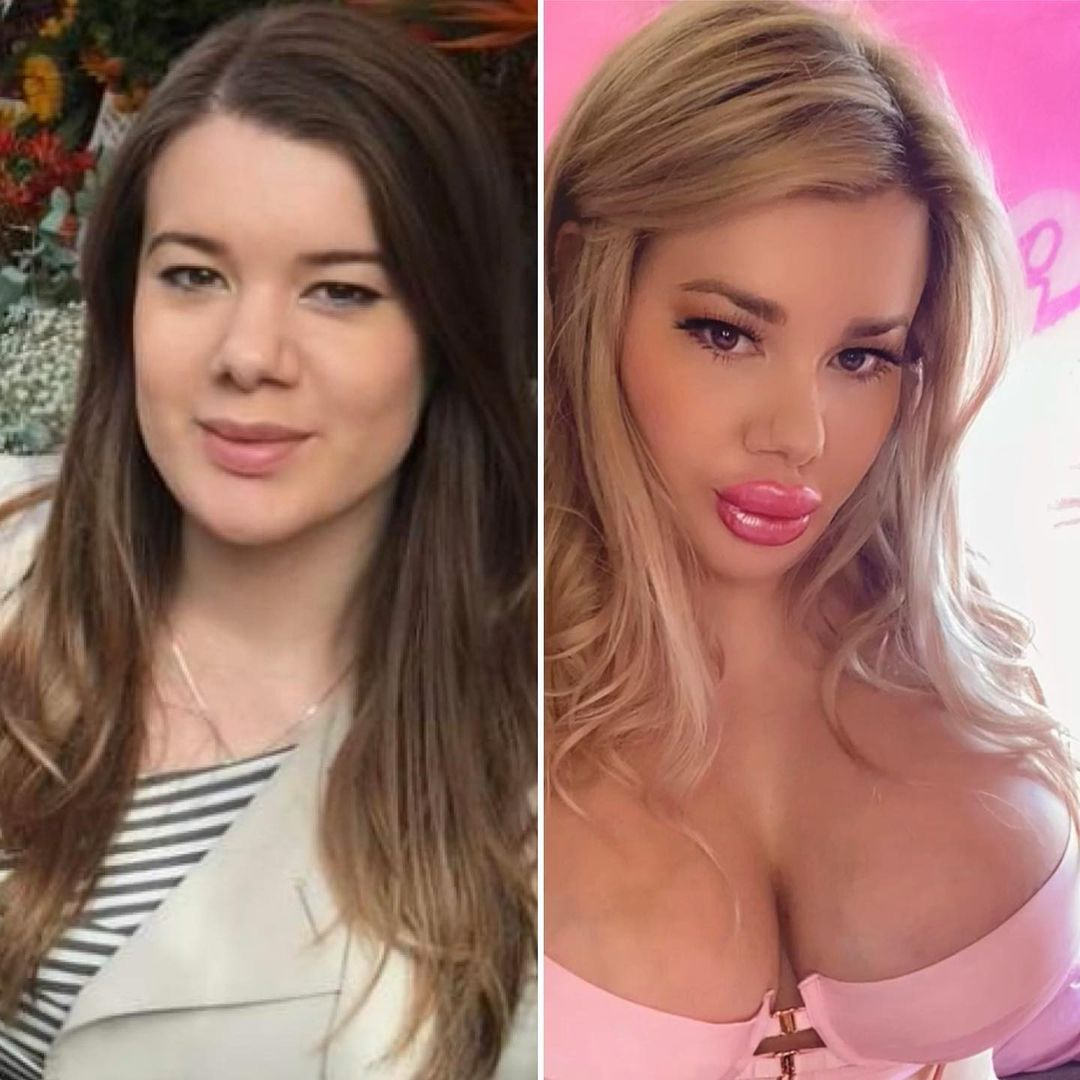 porn star fake tits big lips
