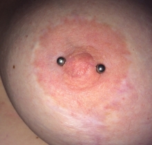 byron pinto recommends nipple piercing gone wrong pic