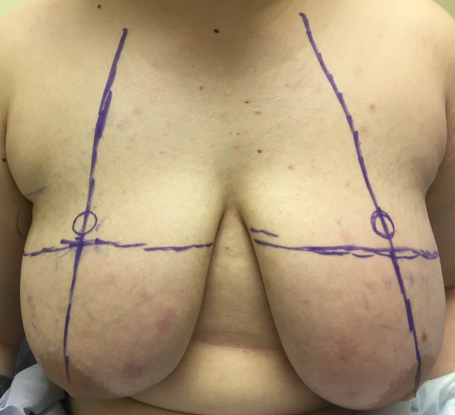 don tully recommends post op shemale pics pic