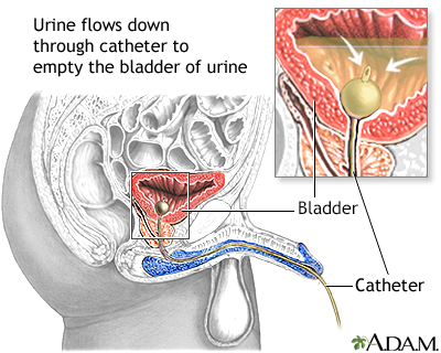 Best of Blowing air into urethra