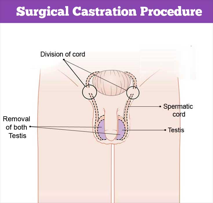 aleeza rani recommends castration video human surgery pic