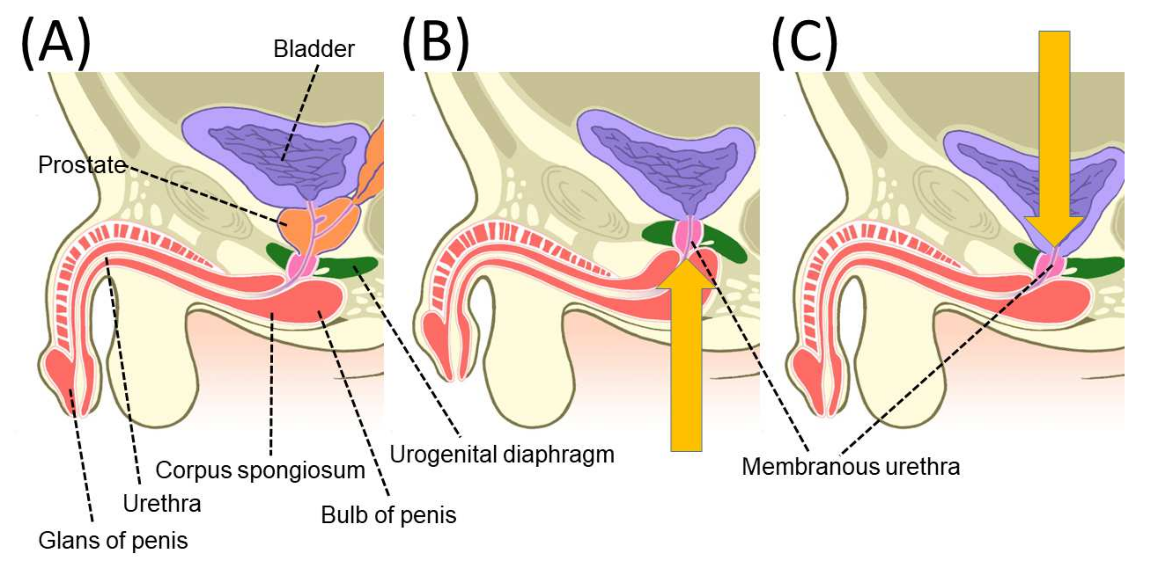 chuck oconnell add photo pumping air into urethra