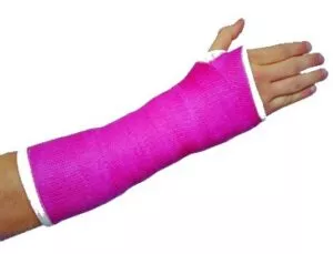 fake cast for arm