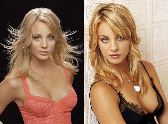 kaley cuoco breast expansion