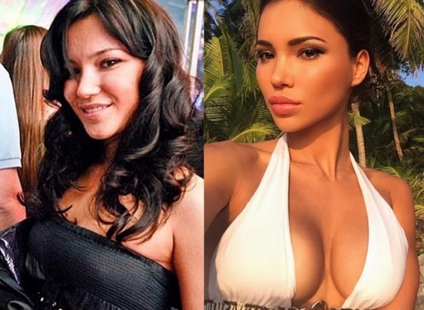 christa guerrieri recommends sveta bilyalova before surgery pic