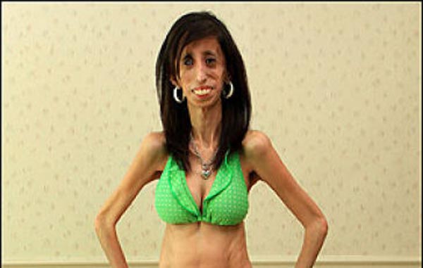 amanda malfitano share skinniest woman in the world photos