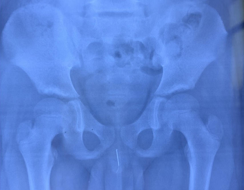 Best of Xray with penis