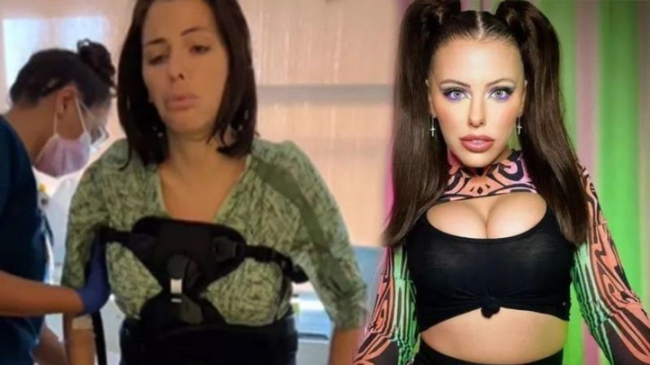 Adriana Chechik Plastic Surgery mods vid