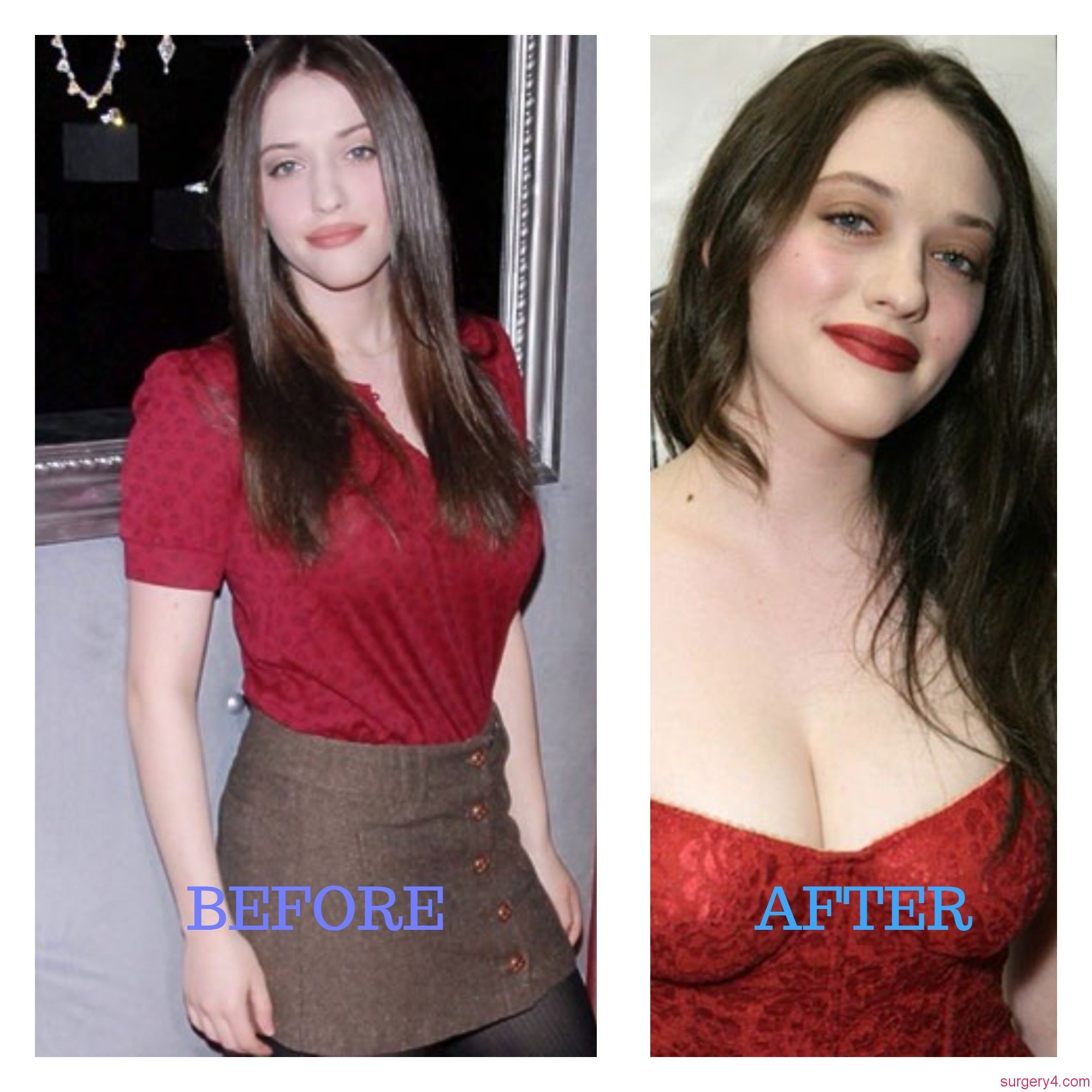 are kat dennings breasts real