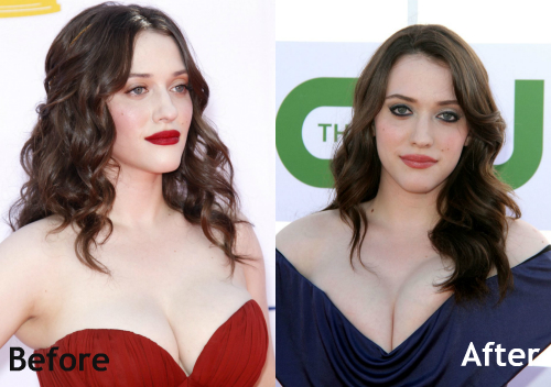 alma glover add photo are kat dennings breasts real