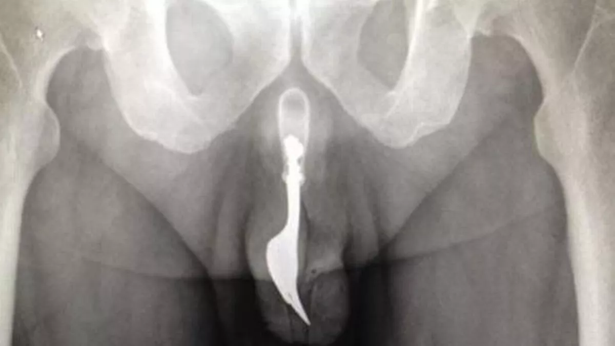big dick x ray