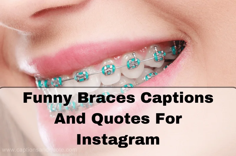 anupam aryan recommends Captions For Getting Braces Off