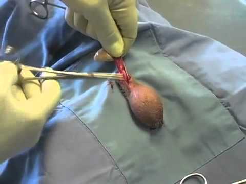 callum lambert add castration video human surgery photo