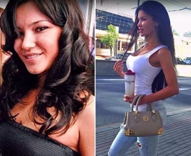 clinton fair recommends Sveta Bilyalova Before Surgery