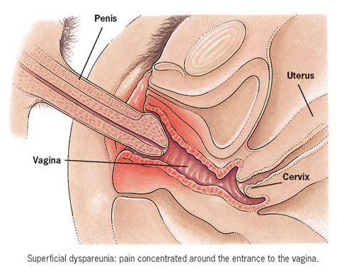 artie webster recommends Dick In Vagina Pics