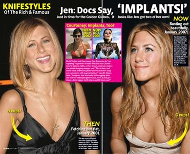 Does Jennifer Aniston Have Fake Boobs pussy slide