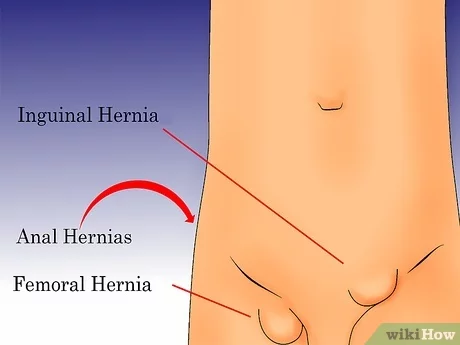 donna hedgepath share hernia exam female doctor photos