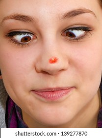 Best of Girls with fat noses