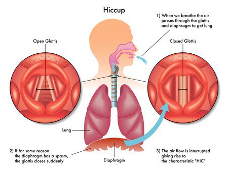 brandon fiske add hiccups and burps together photo