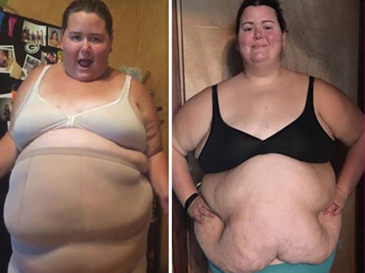 Morbidly Obese Women Naked terumi slideshow