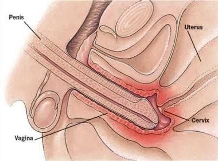 clara donovan recommends Penis Insertion In Vagina