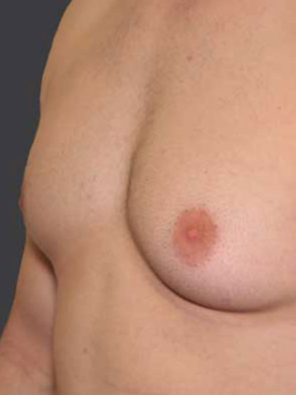 crystal gleason recommends Puffy Nip Pic