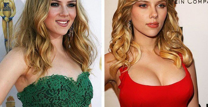 cecile lawrence add scarlett johansson fake breasts photo