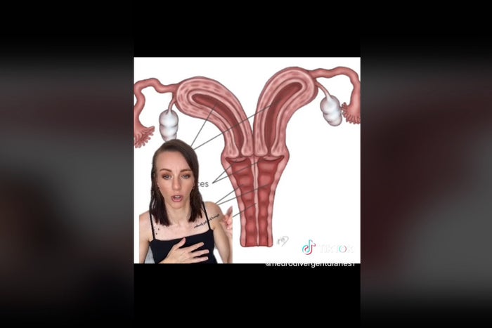 christine goeller recommends Woman With Two Vaginas Picture