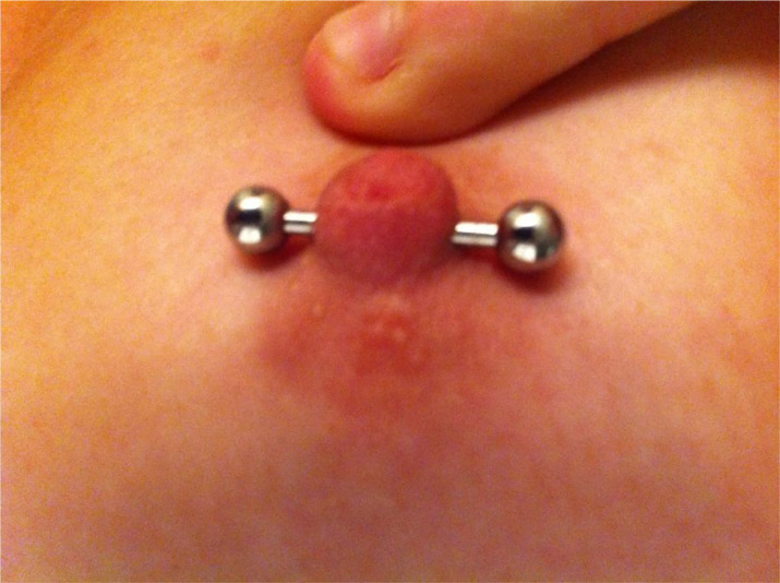 women getting clit pierced